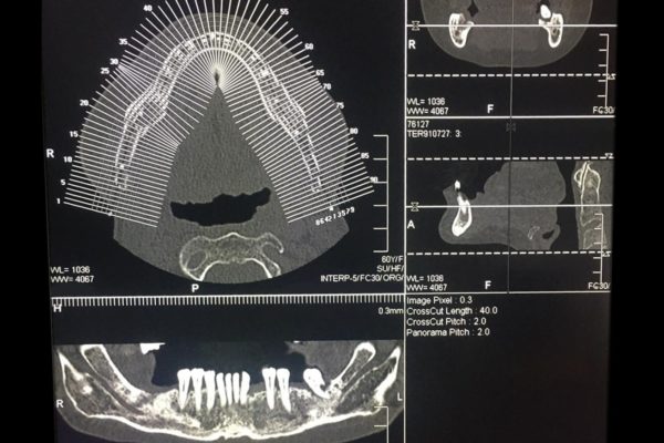 https://www.centromedicopiras.it/wp-content/uploads/2020/02/PHOTO-2020-02-20-11-58-17-600x400.jpg